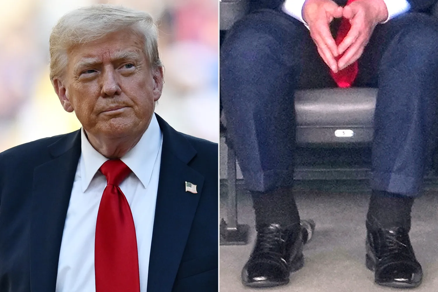 Trump Venous Insufficiency